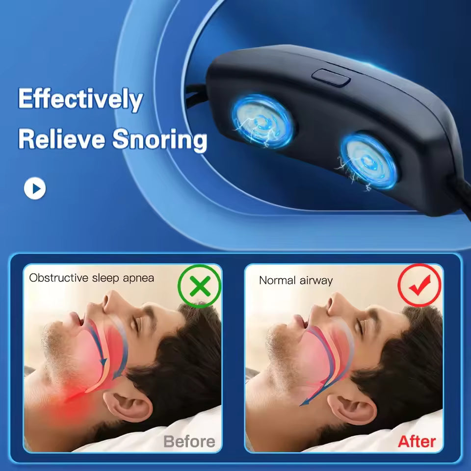 Electric Anti-Snoring Device